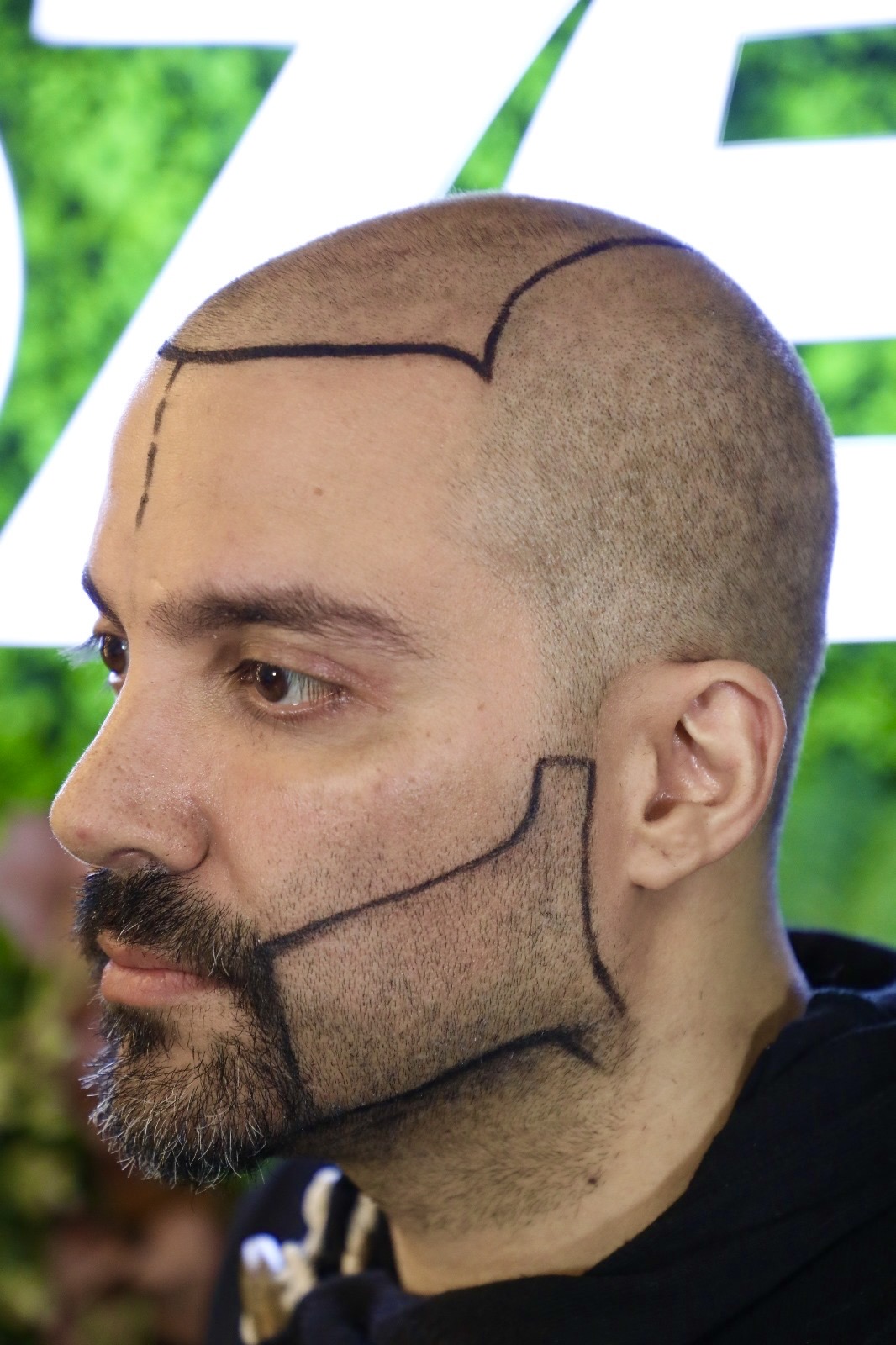 Hairline and beard line drawn to match the client's profile