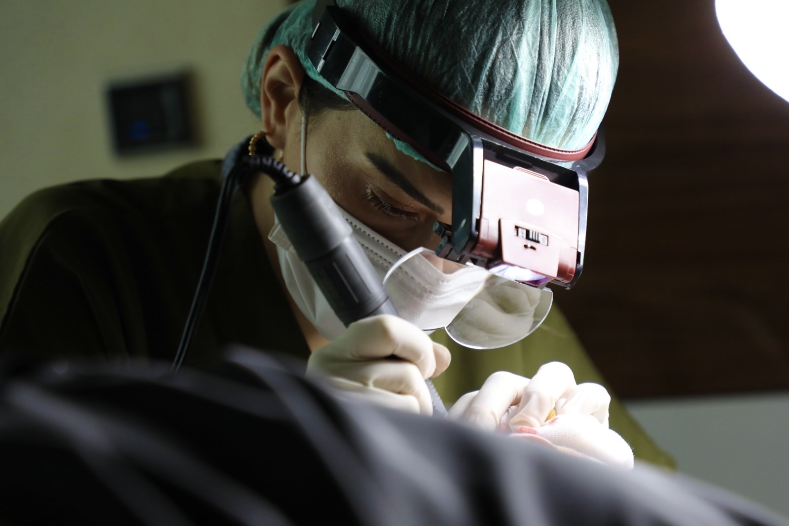 FUE graft extraction under magnification at OZEL Hair Transplant Istanbul