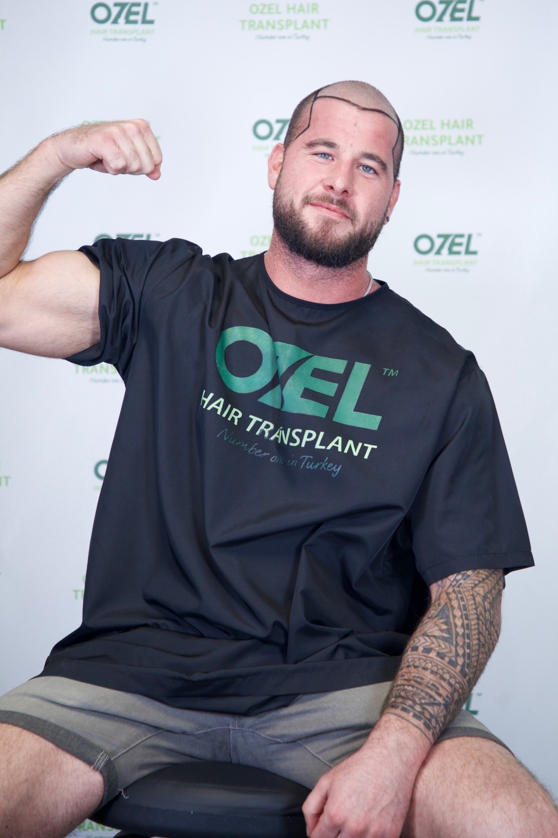 An OZEL client flexing his arm with a confident smile