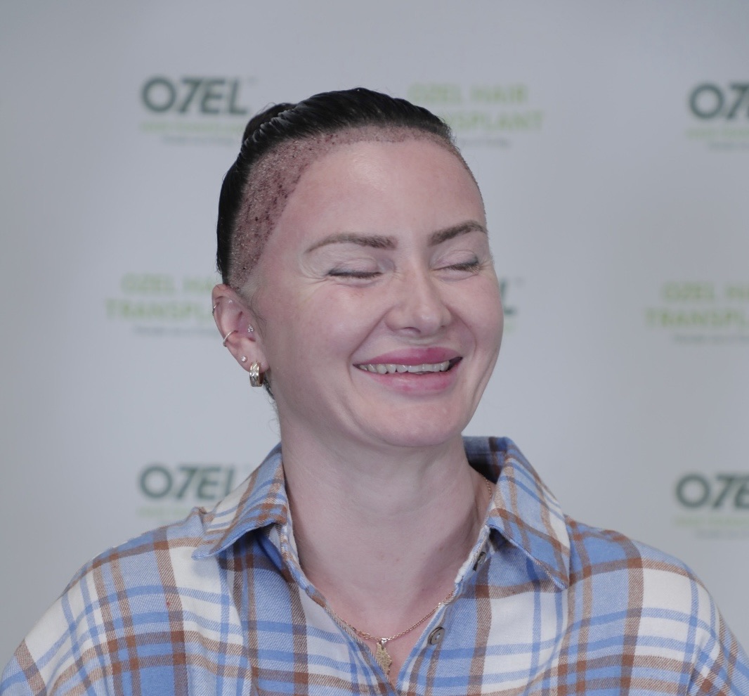 A smiling woman just after her female hair transplant at OZEL Hair Transplant Istanbul